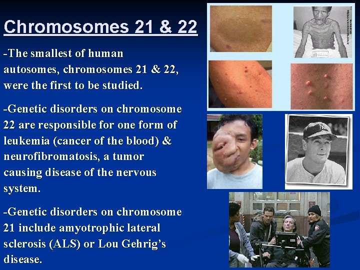 Chromosomes 21 & 22 -The smallest of human autosomes, chromosomes 21 & 22, were