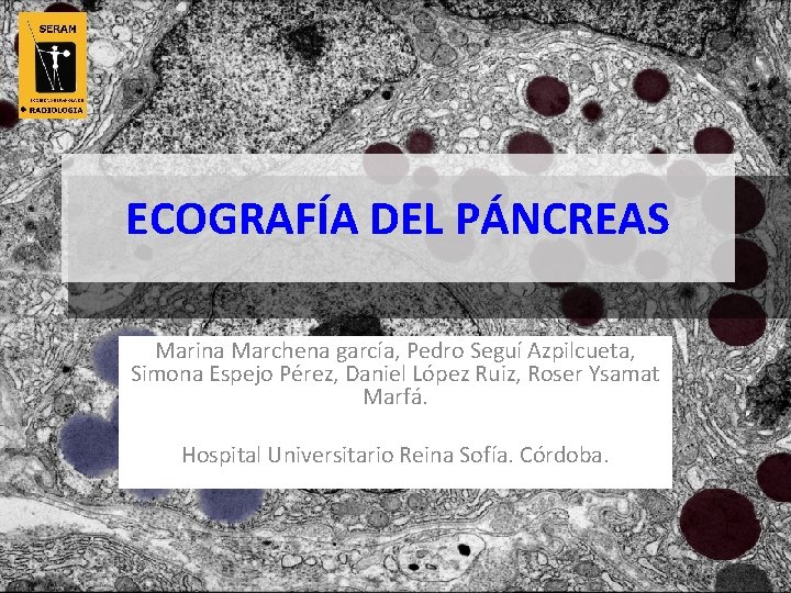 ECOGRAFÍA DEL PÁNCREAS Marina Marchena garcía, Pedro Seguí Azpilcueta, Simona Espejo Pérez, Daniel López