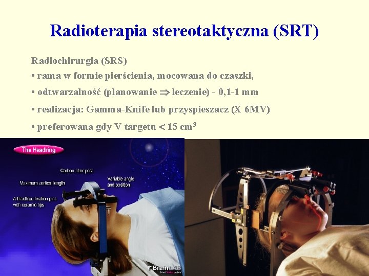 Radioterapia stereotaktyczna (SRT) Radiochirurgia (SRS) • rama w formie pierścienia, mocowana do czaszki, •