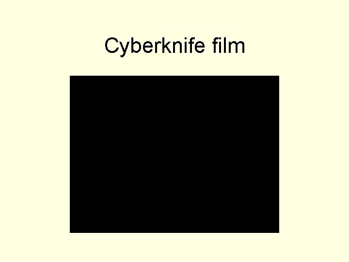 Cyberknife film 