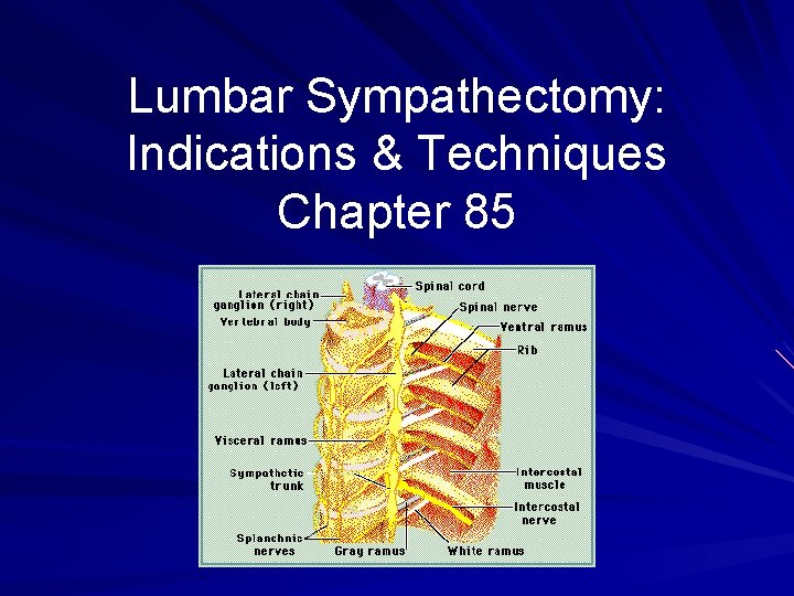 Lumbar Sympathectomy: Indications & Techniques Chapter 85 