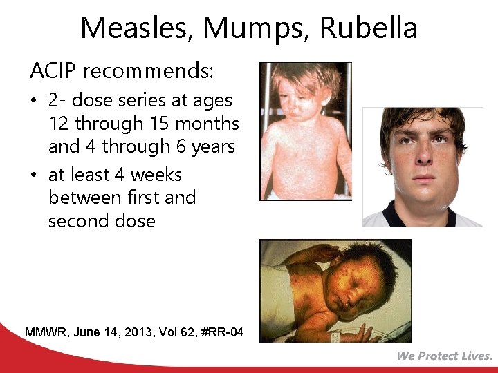 Measles, Mumps, Rubella ACIP recommends: • 2 - dose series at ages 12 through