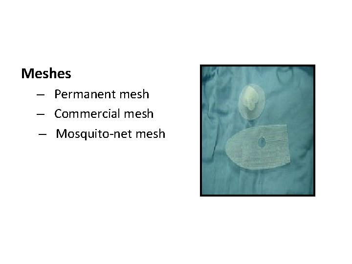 Meshes – Permanent mesh – Commercial mesh – Mosquito-net mesh 