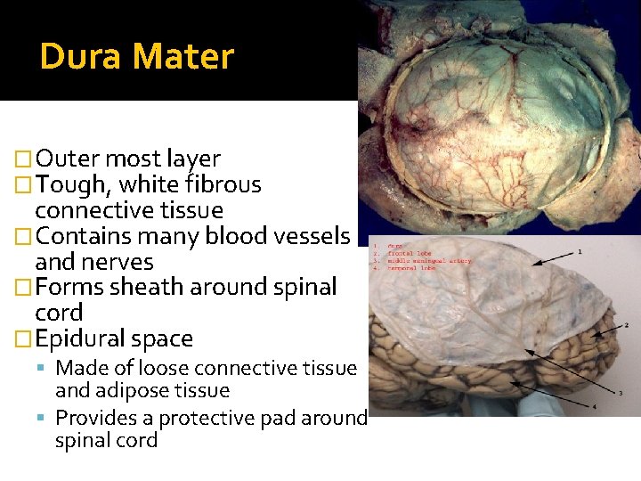 Dura Mater �Outer most layer �Tough, white fibrous connective tissue �Contains many blood vessels