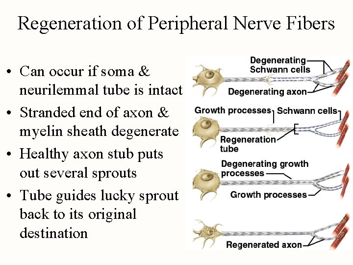 Regeneration of Peripheral Nerve Fibers • Can occur if soma & neurilemmal tube is