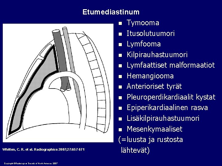 Etumediastinum n Tymooma n Itusolutuumori n Lymfooma n Kilpirauhastuumori n Lymfaattiset malformaatiot n Hemangiooma