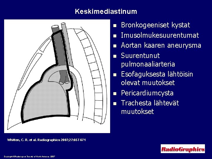 Keskimediastinum n n n n Whitten, C. R. et al. Radiographics 2007; 27: 657