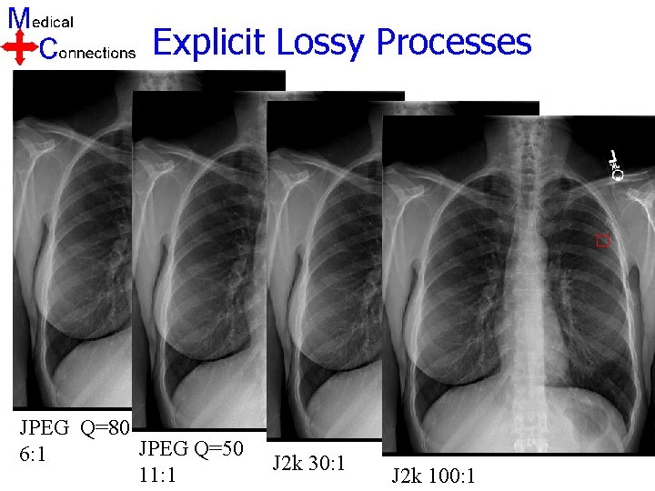 Explicit Lossy Processes JPEG Q=80 JPEG Q=50 6: 1 11: 1 J 2 k