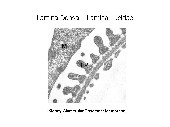 Lamina Densa + Lamina Lucidae Kidney Glomerular Basement Membrane Lamina Densa + Lamina Lucidae Kidney Glomerular Basement Membrane