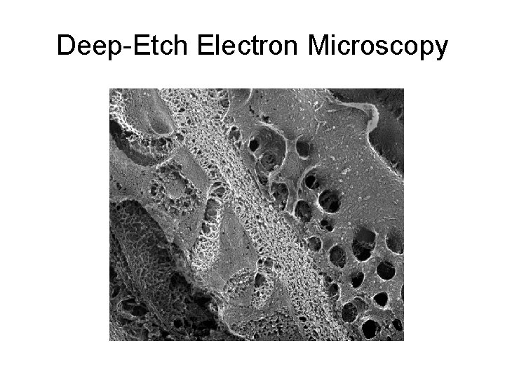 Deep-Etch Electron Microscopy 