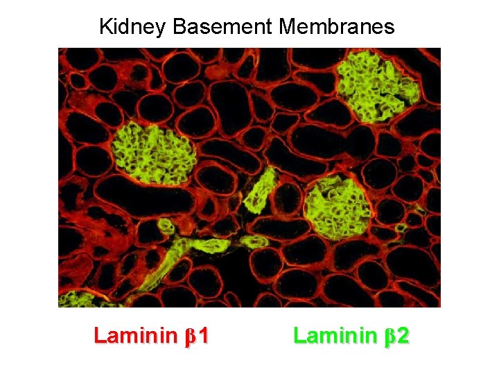 Kidney Basement Membranes Laminin β 1 Laminin β 2 