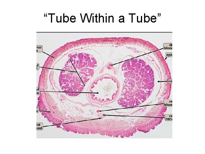 “Tube Within a Tube” 