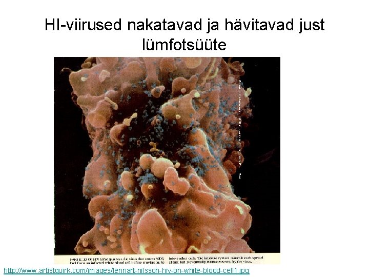 HI-viirused nakatavad ja hävitavad just lümfotsüüte http: //www. artistquirk. com/images/lennart-nilsson-hiv-on-white-blood-cell 1. jpg 