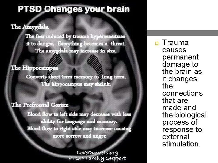 Trauma causes permanent damage to the brain as it changes the connections that Trauma causes permanent damage to the brain as it changes the connections that