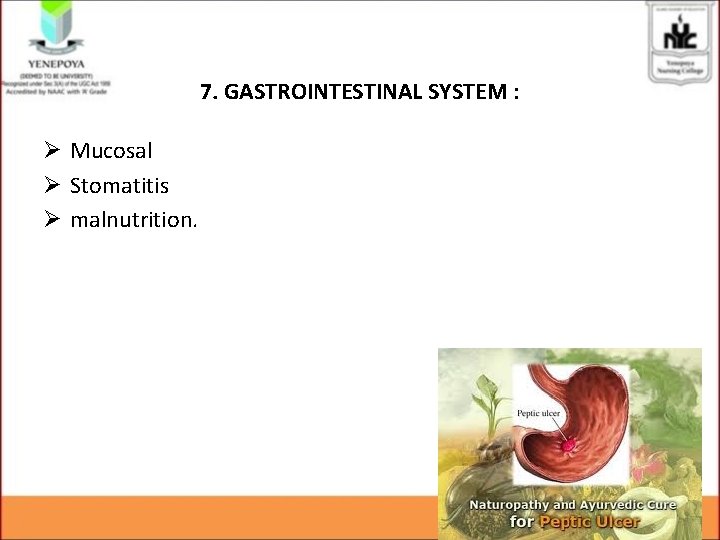 7. GASTROINTESTINAL SYSTEM : Ø Mucosal Ø Stomatitis Ø malnutrition. 