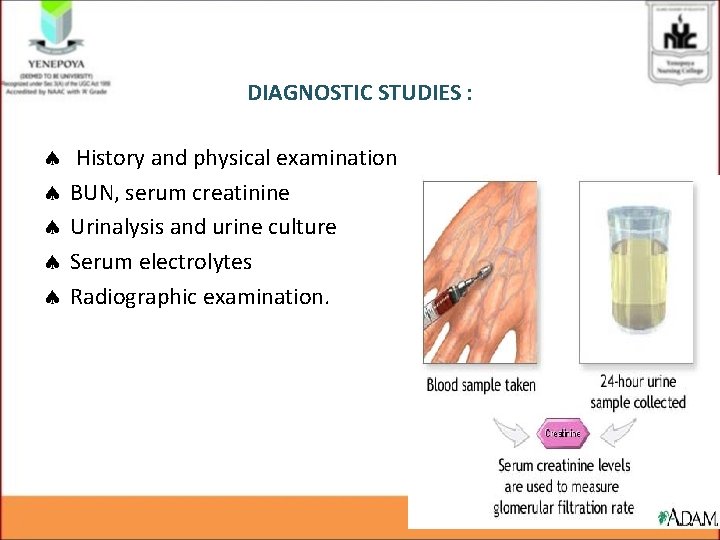 DIAGNOSTIC STUDIES : History and physical examination BUN, serum creatinine Urinalysis and urine culture