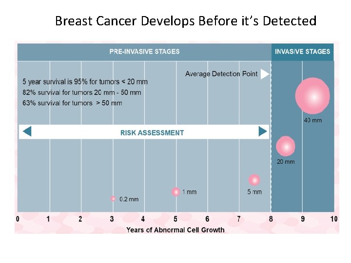 Breast Cancer Develops Before it’s Detected Breast Cancer Develops Before it’s Detected