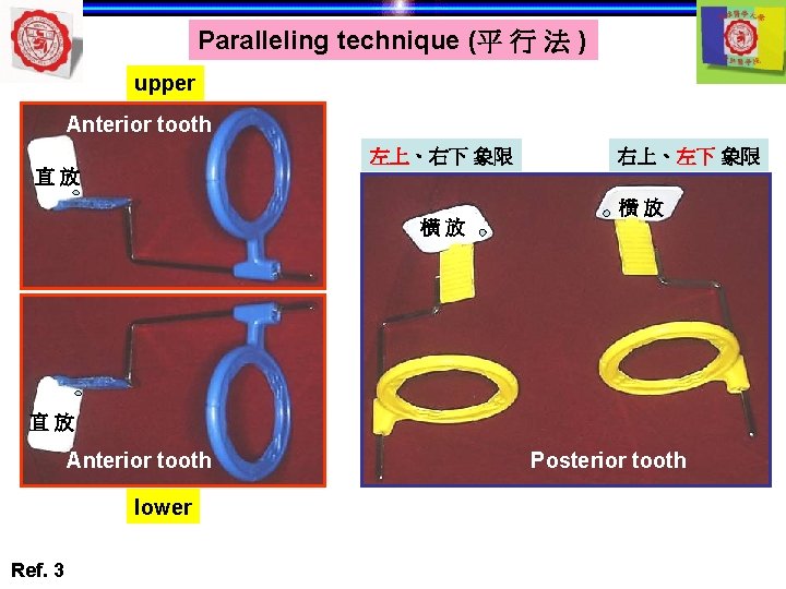 Paralleling technique (平 行 法 ) upper Anterior tooth 左上、右下 象限 右上、左下 象限 直放