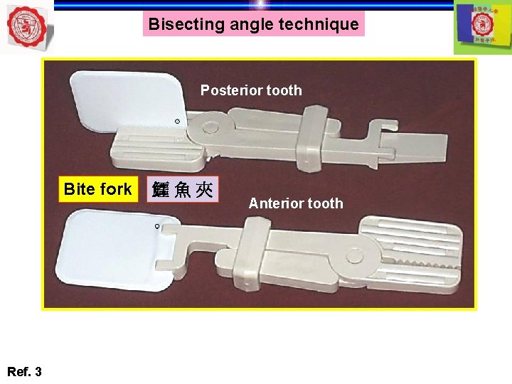 Bisecting angle technique Posterior tooth Bite fork Ref. 3 鱷魚夾 Anterior tooth 