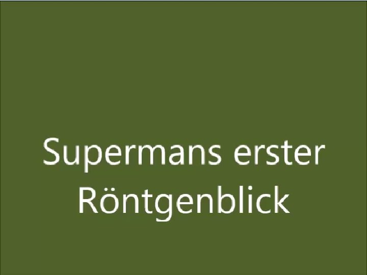 Röntgenstrahlen © Prof. Dr. Remo Ianniello 30 