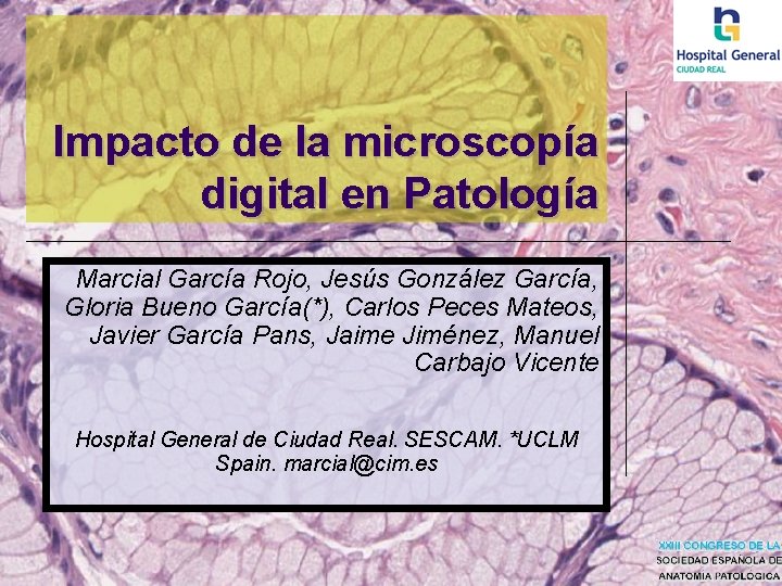 Impacto de la microscopía digital en Patología Marcial García Rojo, Jesús González García, Gloria