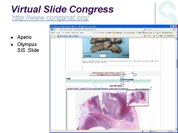 Virtual Slide Congress http: //www. conganat. org/ Aperio Olympus SIS. Slide 