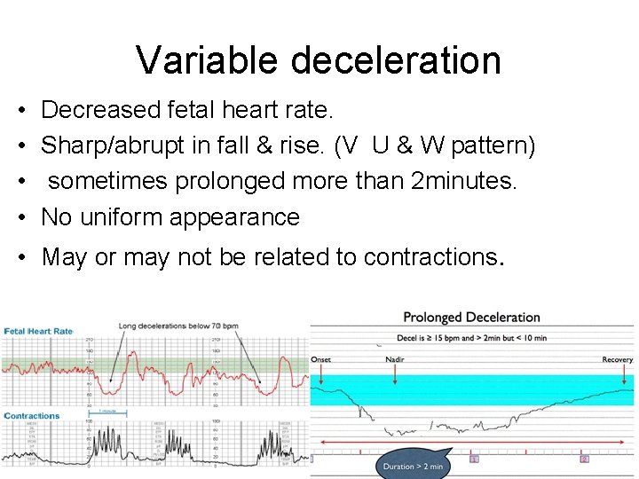 Variable deceleration • • Decreased fetal heart rate. Sharp/abrupt in fall & rise. (V