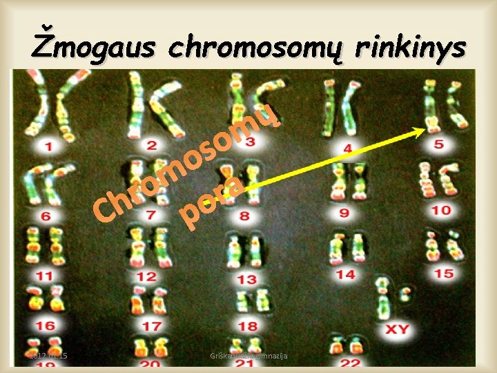 Žmogaus chromosomų rinkinys ų m o s o m o a r r h