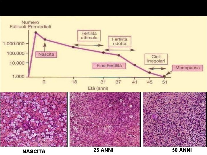 INVECCHIAMENTO OVARICO 1 -2 milioni/nascita 300 -500 mila/puberta’ 25. 000 /37 anni 1. 000/