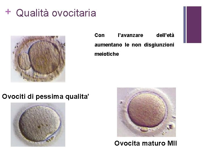 + Qualità ovocitaria Con l’avanzare dell’età aumentano le non disgiunzioni meiotiche Ovociti di pessima