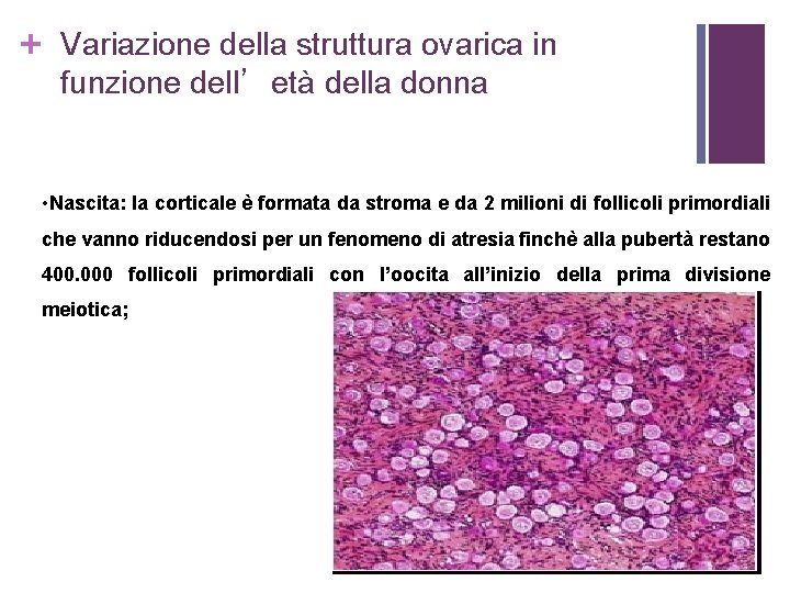 + Variazione della struttura ovarica in funzione dell’età della donna • Nascita: la corticale