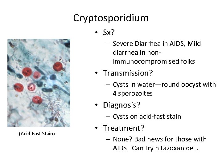 Cryptosporidium • Sx? – Severe Diarrhea in AIDS, Mild diarrhea in nonimmunocompromised folks •