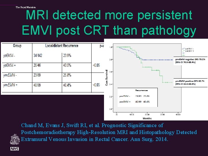 The Royal Marsden MRI detected more persistent EMVI post CRT than pathology Chand M,
