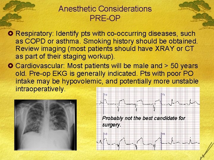 Anesthetic Considerations PRE-OP £ Respiratory: Identify pts with co-occurring diseases, such as COPD or
