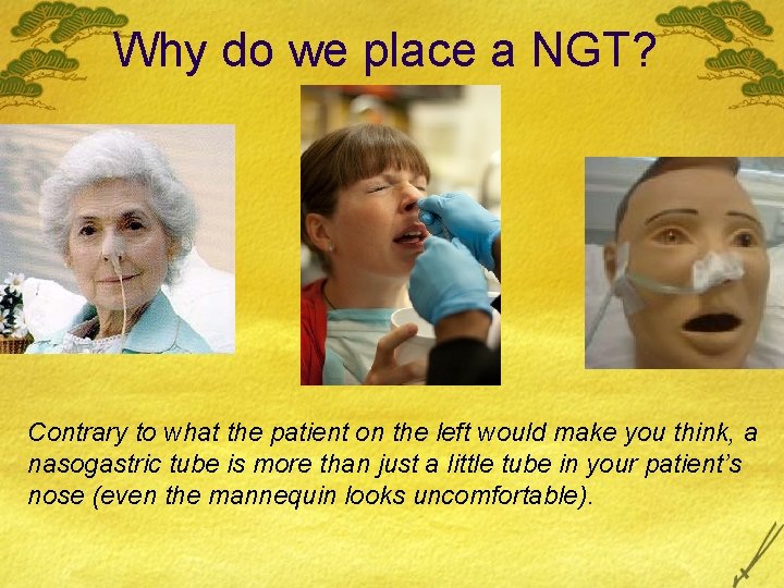 Why do we place a NGT? Contrary to what the patient on the left