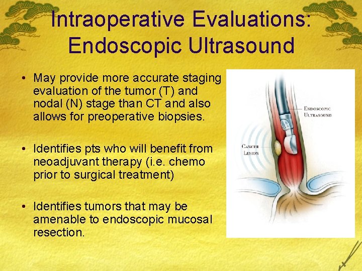 Intraoperative Evaluations: Endoscopic Ultrasound • May provide more accurate staging evaluation of the tumor