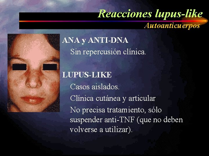 Reacciones lupus-like Autoanticuerpos ANA y ANTI-DNA Sin repercusión clínica. LUPUS-LIKE Casos aislados. Clínica cutánea