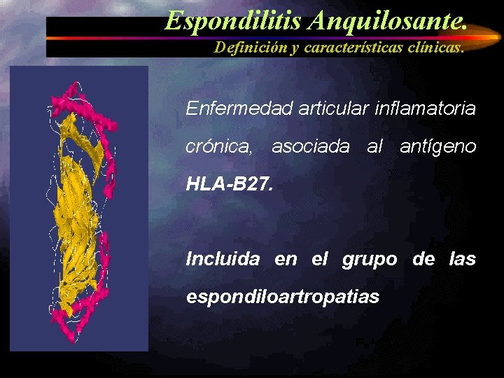 Espondilitis Anquilosante. Definición y características clínicas. Enfermedad articular inflamatoria crónica, asociada al antígeno HLA-B