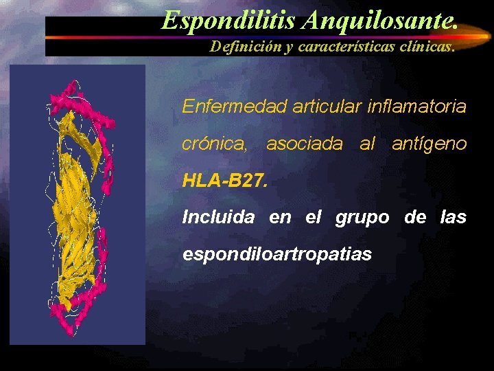 Espondilitis Anquilosante. Definición y características clínicas. Enfermedad articular inflamatoria crónica, asociada al antígeno HLA-B