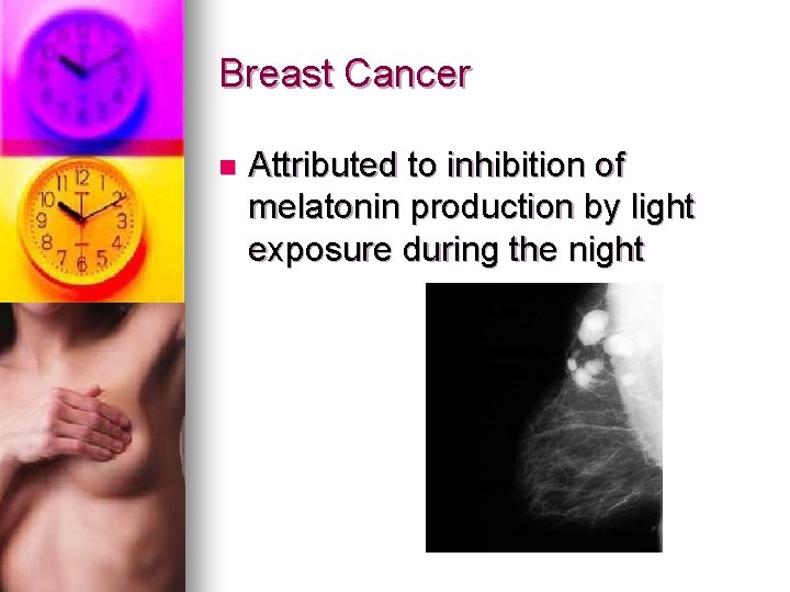 Breast Cancer n Attributed to inhibition of melatonin production by light exposure during the Breast Cancer n Attributed to inhibition of melatonin production by light exposure during the