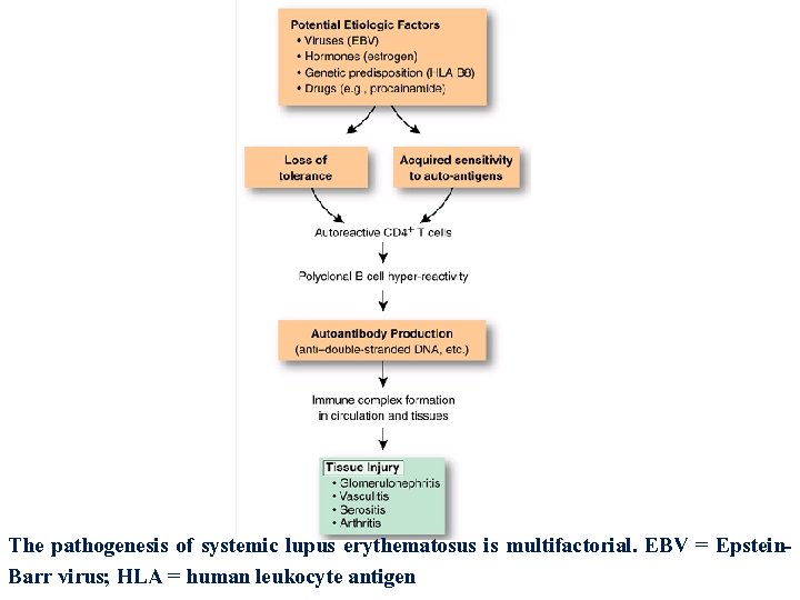 The pathogenesis of systemic lupus erythematosus is multifactorial. EBV = Epstein. Barr virus; HLA