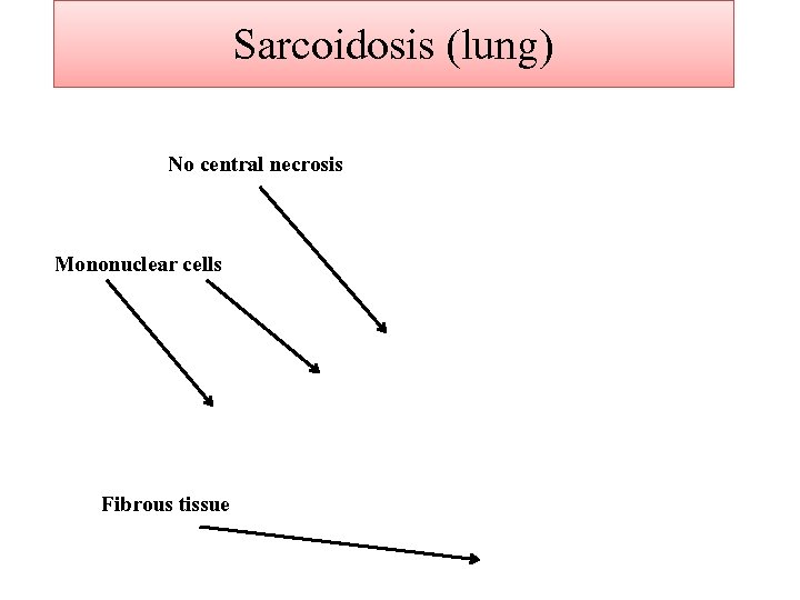 Sarcoidosis (lung) No central necrosis Mononuclear cells Fibrous tissue 