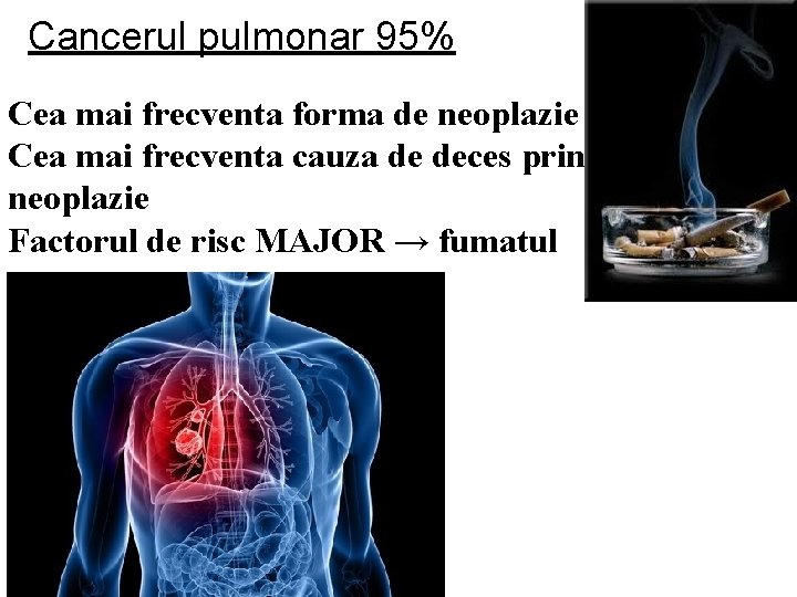 Cancerul pulmonar 95% Cea mai frecventa forma de neoplazie Cea mai frecventa cauza de Cancerul pulmonar 95% Cea mai frecventa forma de neoplazie Cea mai frecventa cauza de