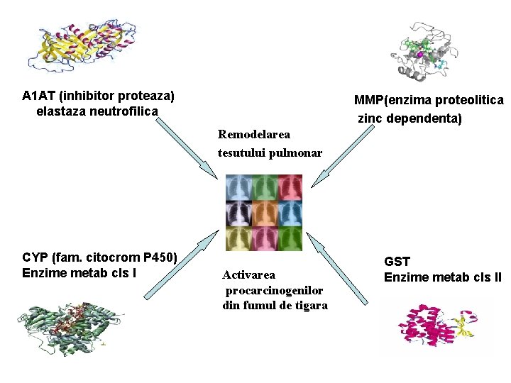 A 1 AT (inhibitor proteaza) elastaza neutrofilica MMP(enzima proteolitica zinc dependenta) Remodelarea tesutului pulmonar A 1 AT (inhibitor proteaza) elastaza neutrofilica MMP(enzima proteolitica zinc dependenta) Remodelarea tesutului pulmonar