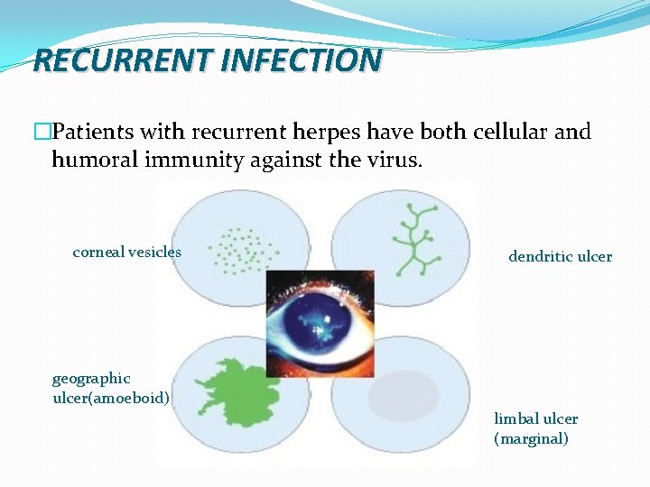 RECURRENT INFECTION �Patients with recurrent herpes have both cellular and humoral immunity against the