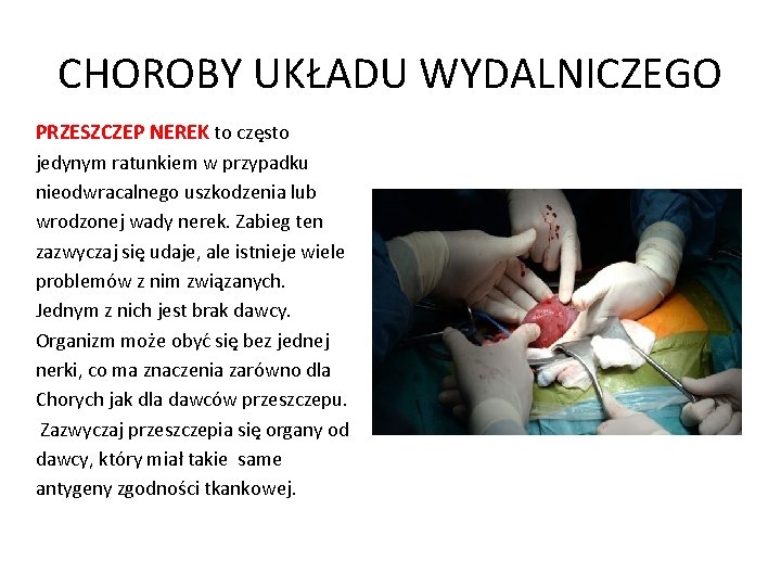CHOROBY UKŁADU WYDALNICZEGO PRZESZCZEP NEREK to często jedynym ratunkiem w przypadku nieodwracalnego uszkodzenia lub