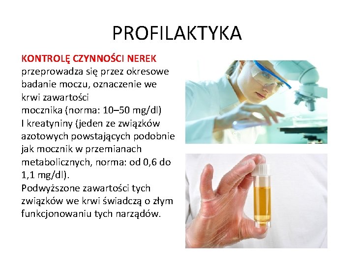 PROFILAKTYKA KONTROLĘ CZYNNOŚCI NEREK przeprowadza się przez okresowe badanie moczu, oznaczenie we krwi zawartości