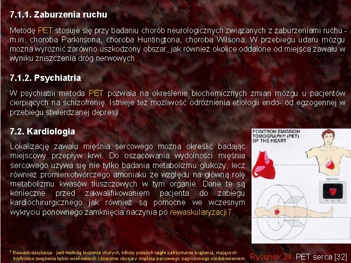 7. 1. 1. Zaburzenia ruchu Metodę PET stosuje się przy badaniu chorób neurologicznych związanych