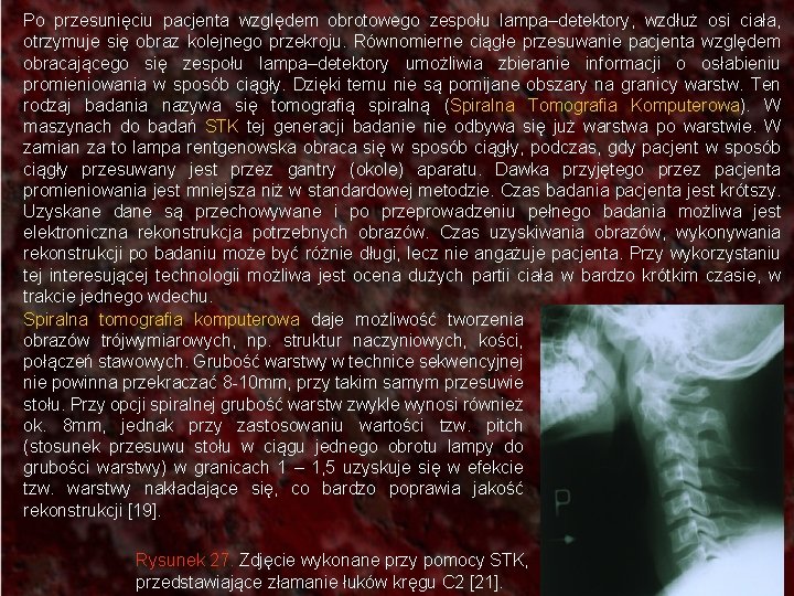 Po przesunięciu pacjenta względem obrotowego zespołu lampa–detektory, wzdłuż osi ciała, otrzymuje się obraz kolejnego