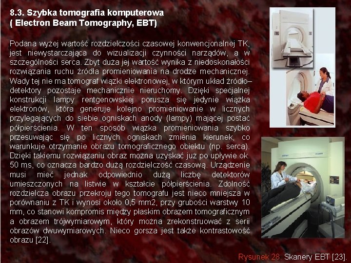 8. 3. Szybka tomografia komputerowa ( Electron Beam Tomography, EBT) Podana wyżej wartość rozdzielczości